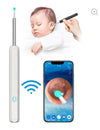 Zalviro Next Gen Intelligent Visual Ear Cleaner Device Featuring High Definition Lens and Sleek Matte Body Architecture