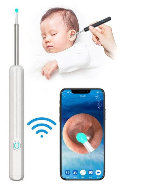 Zalviro Next Gen Intelligent Visual Ear Cleaner Device Featuring High Definition Lens and Sleek Matte Body Architecture