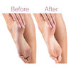 Clinical Before and After Side by Side Feet Contrast Showcasing Dead Skin Elimination and Deep Cracked Heel Repair